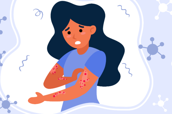 Psoriasis - August is National Psoriasis awareness month!